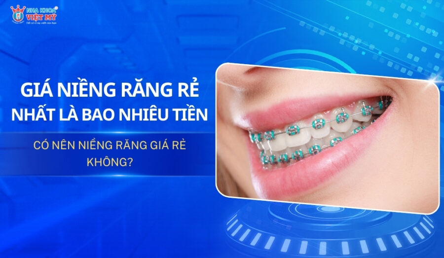 Giá niềng răng rẻ nhất là bao nhiêu? Bảng giá mới nhất 2025