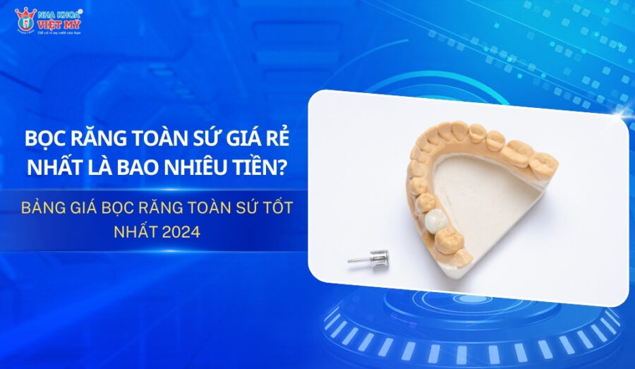 Chi phí bọc răng toàn sứ giá rẻ bao nhiêu tiền? [Tháng 1/2025]