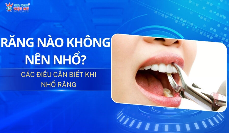 thumbnail răng nào không nên nhổ