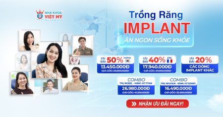 Trồng răng Implant ưu đãi 50% – Ăn ngon sống khỏe