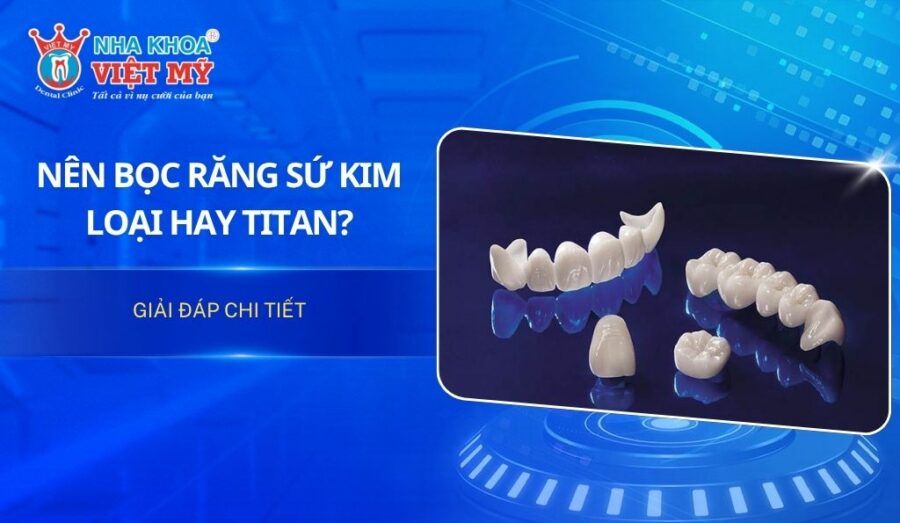 Nên bọc răng sứ kim loại hay Titan? Giải đáp chi tiết